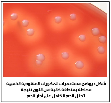  />الجهاز التنفسي. إلا أنها يمكن أن تتسبب بمجموعة من الأمراض، من التهابات جلدية طفيفة كالبثور، القوباء <span dir=