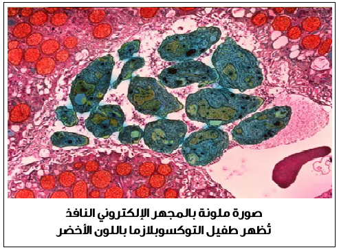 />على سبيل المثال (CSF)، ويمكن الاستفادة من التقنيات الجزيئية للكشف عن الحمض النووي للطفيل في السائل المحيط بالجنين (Amniotic fluid). أما الحالات شديدة الخطورة فيمكن استخدام التصوير بالرنين المغناطيسي لها. معظم الأشخاص الأصحاء لا يحتاجون إلى علاج لداء المقوسات. ولكن قد يصف الطبيب بعض الأدوية مثل Daraprim وSulfadiazine وحمض الفولينيك (leucovorin) للأعراض والعلامات الحادة. ويمكن تجنب الإصابة بالعدوى من خلال لبس القفازات عند التعامل مع التربة، غسل اليدين بالماء والصابون، وتجنب تناول طعام غير مطهو جيداً، وغسل أواني المطبخ باستمرار، وغسل الخضار والفواكه جيداً، وعدم شرب حليب غير مبستر. ويجب على محبي القطط الاهتمام بنظافتها ولبس القفازات عند تنظيف صناديق فضلاتها وكذلك تجنب الاحتكاك بالقطط الضالة.</p>
<p style=
