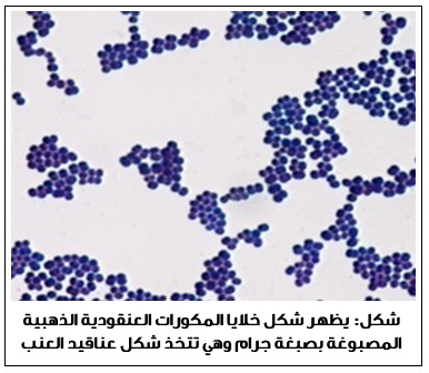  />بشكل عام تنتشر بكتيريا المكورات العنقودية الذهبية (بما في ذلك <span dir=