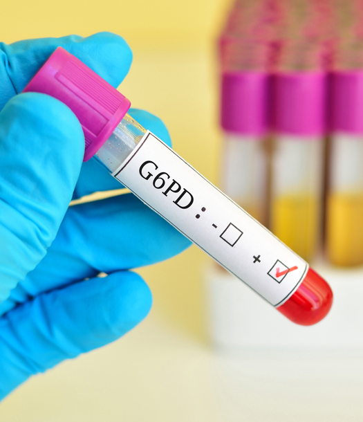 اكتشاف طفرة جديدة لمرض التفول G6PD Gaza